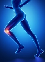 Illustration female runner orthopaedics